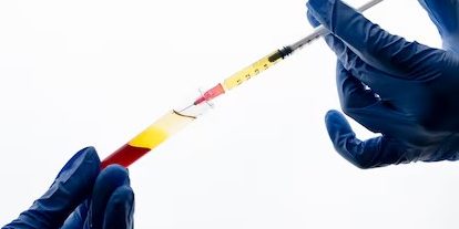 Tendon Travmalarında PRP Tedavisi