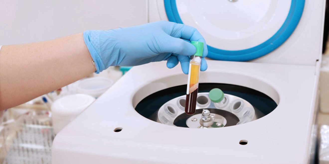 CGF (Cellular Growth Factor) ile Yanık Tedavisi